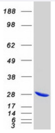 SDS PAGE (RRAS-3690H).jpg
